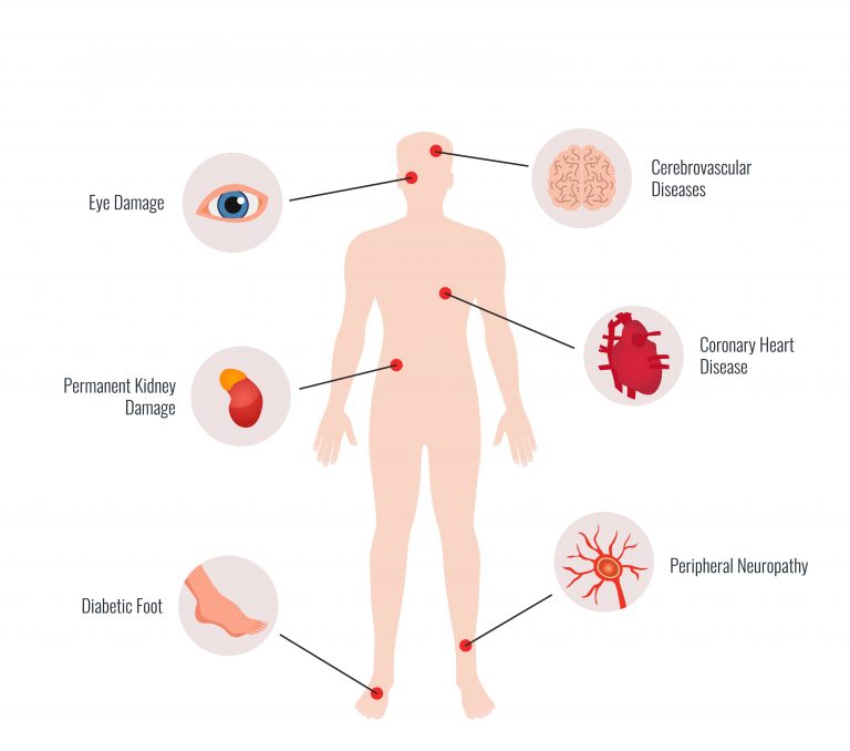 diabetes complications - figure