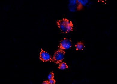 Lipid droplets in macrophages Oil Red O Immune cells